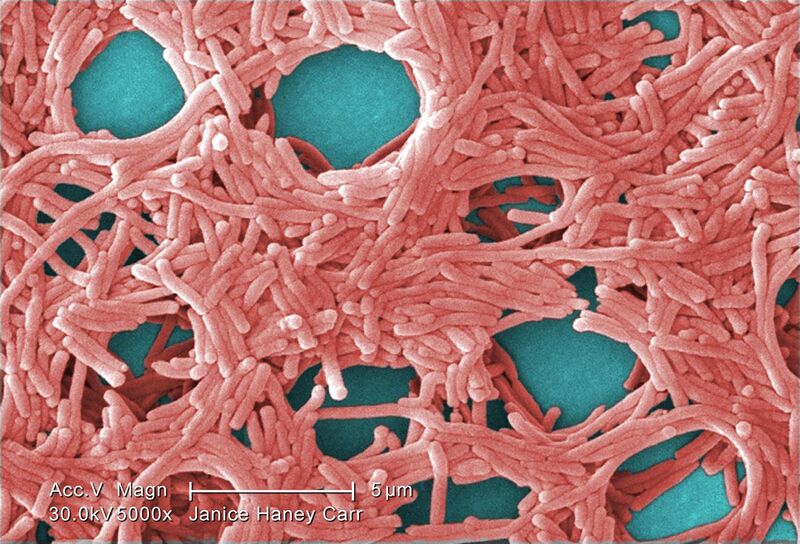 File:Legionella pneumophila (SEM) 2.jpg