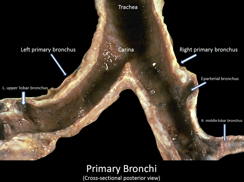 File:Primary bronchi cross-sectional posterior view.PNG