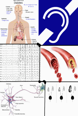 Feigenbaum-Bergeron-Richardson syndrome.png