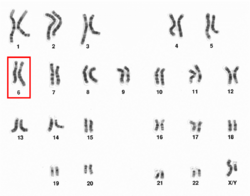 Human male karyotpe high resolution - Chromosome 6.png