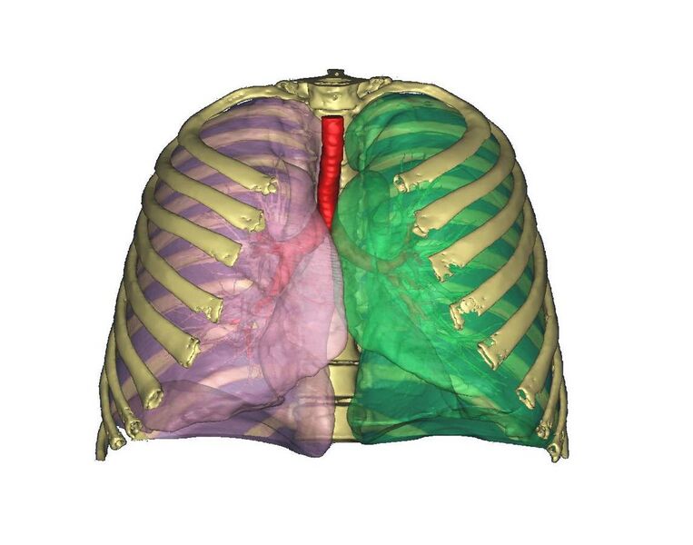 File:3d model of lungs airways ribs.jpg