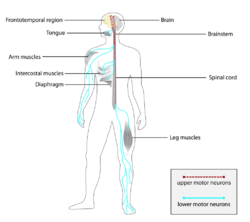 ALS Affected neurons and muscles.png