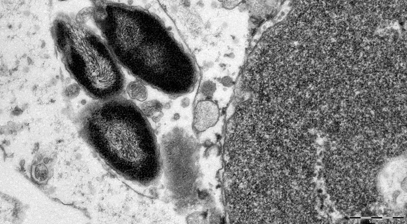 File:Diplorickettsia massiliensis Strain 20B bacteria grown in XTC-2 cells Transmission electron microscopy; staining with uranyl acetate..jpg