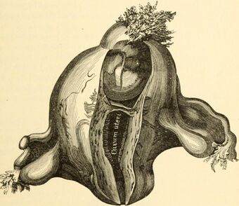 The science and art of midwifery (1897) (14740436436).jpg