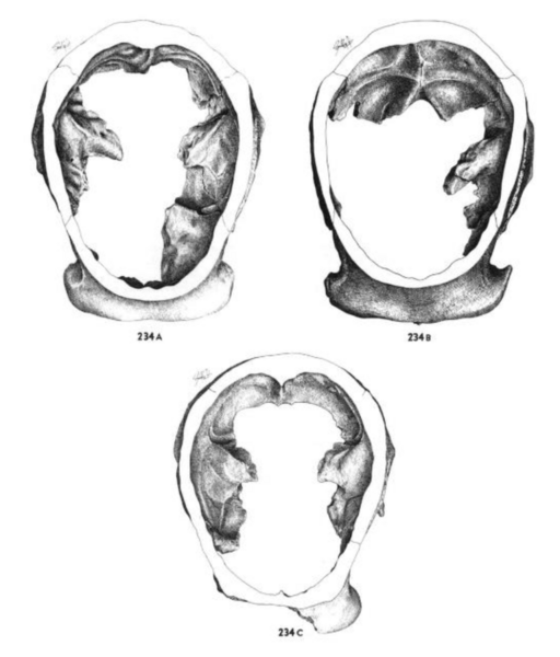 File:Homo erectus skull cross-section.png