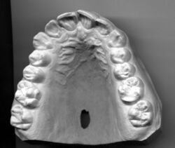 Upper Jaw Dentition.jpeg