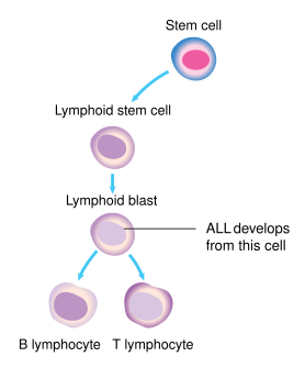 File:Diagram showing the cell that ALL starts in CRUK 295.svg