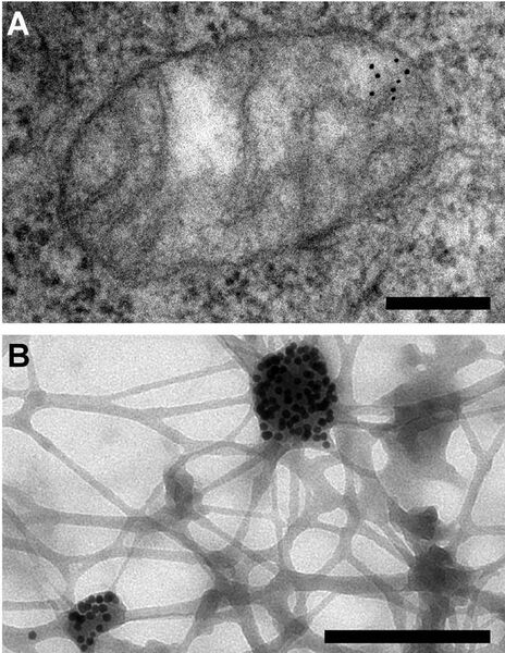 File:Electron microscopy reveals mitochondrial DNA in discrete foci.jpg