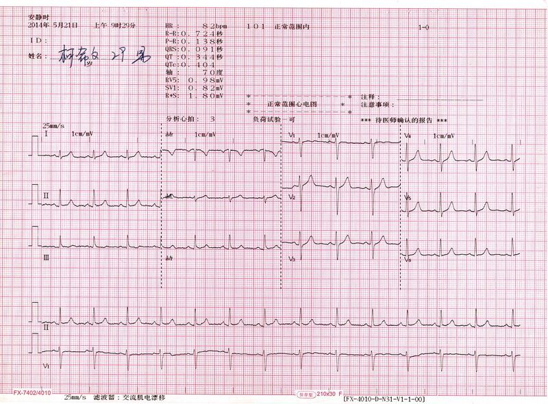 File:Normal 12 lead EKG.jpg