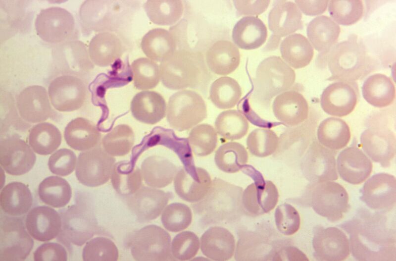 File:T. cruzi trypomastigotes in peripheral blood smear.jpg
