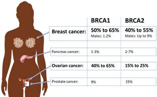 BRCA1 and BRCA2 mutations and absolute cancer risk.jpg