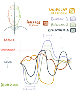 A graph showing mood lability. A neurotypical experiences a variety that never reaches hypomania or depression. Bipolar type 1 involves a manic episode. Bipolar type 2 involves depressive and hypomanic episodes. Cyclothymia involves hypomania and semi-depressive episodes. Unipolar depression involves periods of depression with some normal moods.