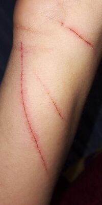 Cat scratches in arm 20210220 000618 618.jpg