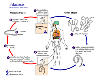 Filariasis 01.png