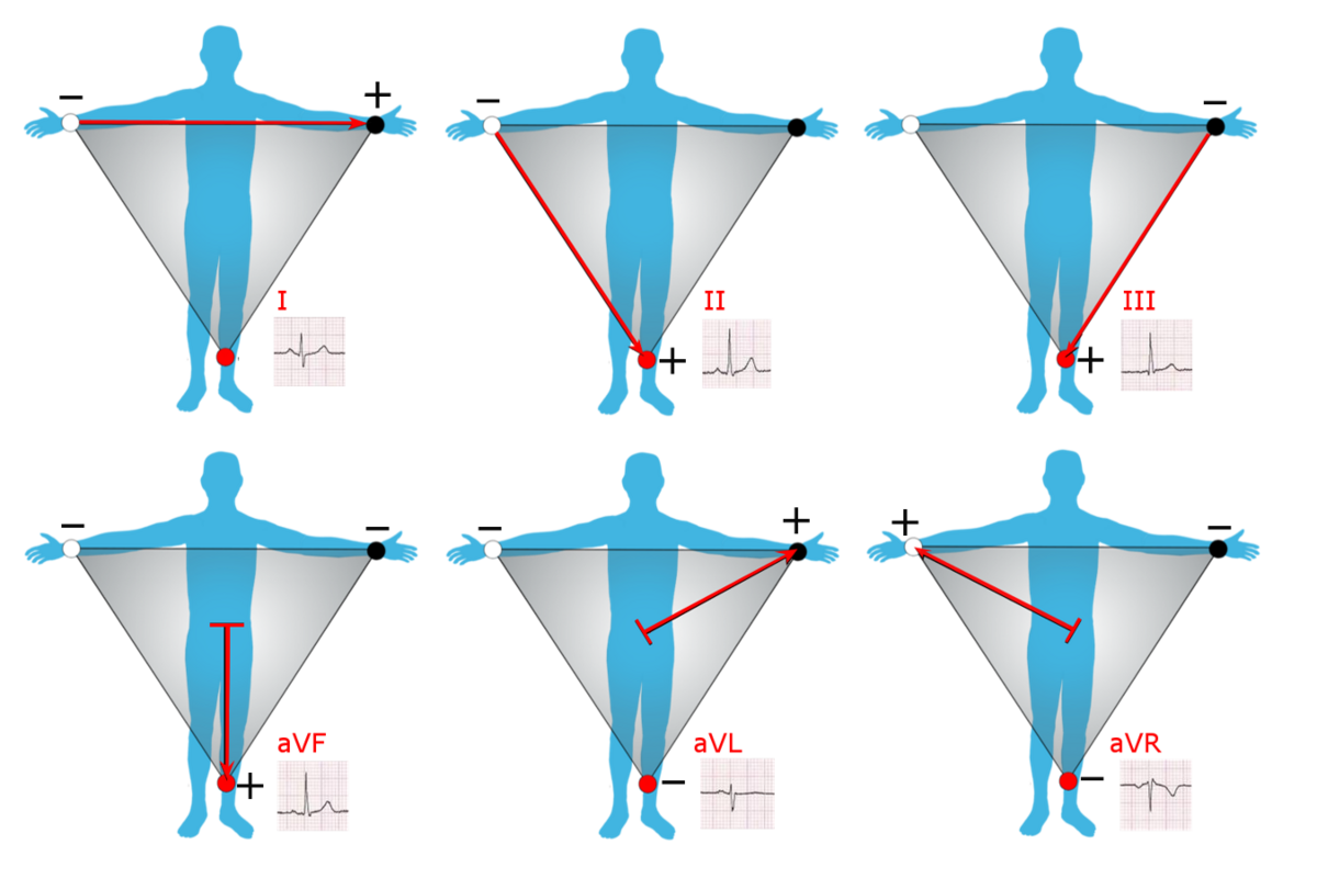 medicine-einthoven-s-triangle-handwiki