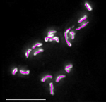 Chromosomal spreads of single itch mite (Sarcoptes scabiei) cell - 17 chromosomes.png