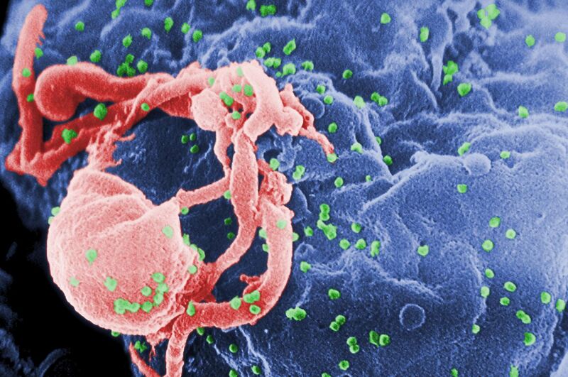 File:HIV-budding-Color.jpg