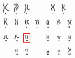 Human male karyotpe high resolution - Chromosome 15.png