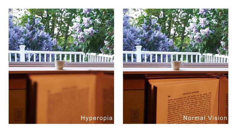 File:Hyperopia comparison.jpg