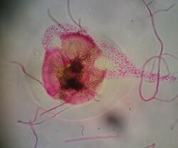 Phoma-Coelomycetes Pycnidia.jpg