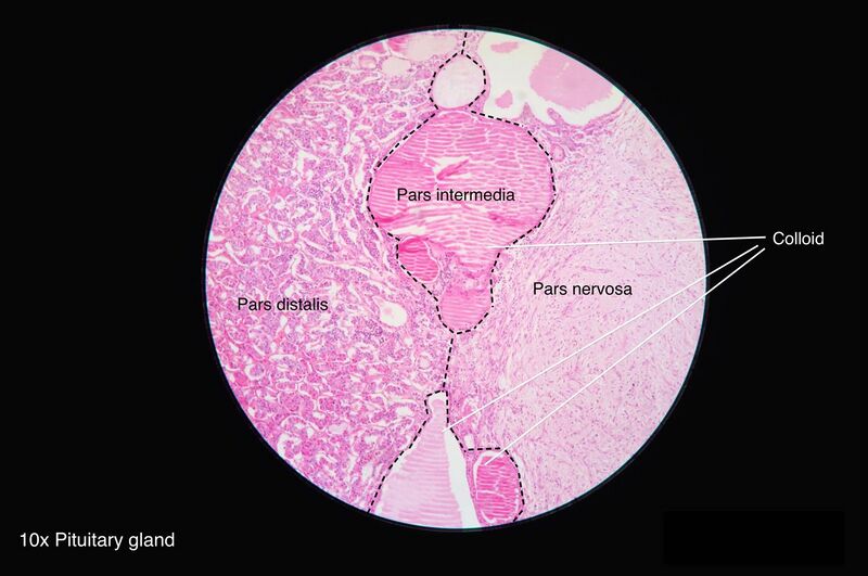 File:Pituitary gland histology 2014.jpg