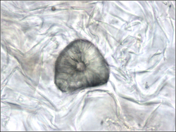 Plant cell type sclerenchyma sclereid.png