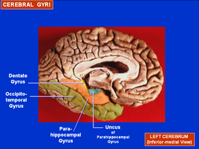 Cerebral Gyri - Medial Surface2.png