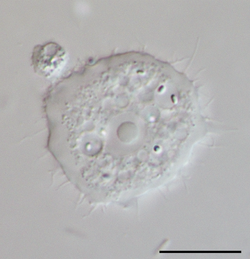 Parasite140120-fig3 Acanthamoeba keratitis Figure 3B.png