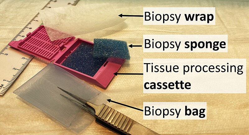 File:Biopsy wrap, biopsy sponge, tissue processing cassette and biopsy bag.jpg