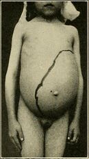 Diseases of children (1916) (14579743737).jpg