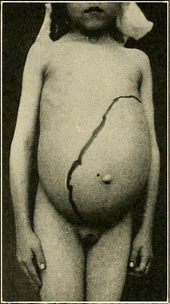 File:Diseases of children (1916) (14579743737).jpg