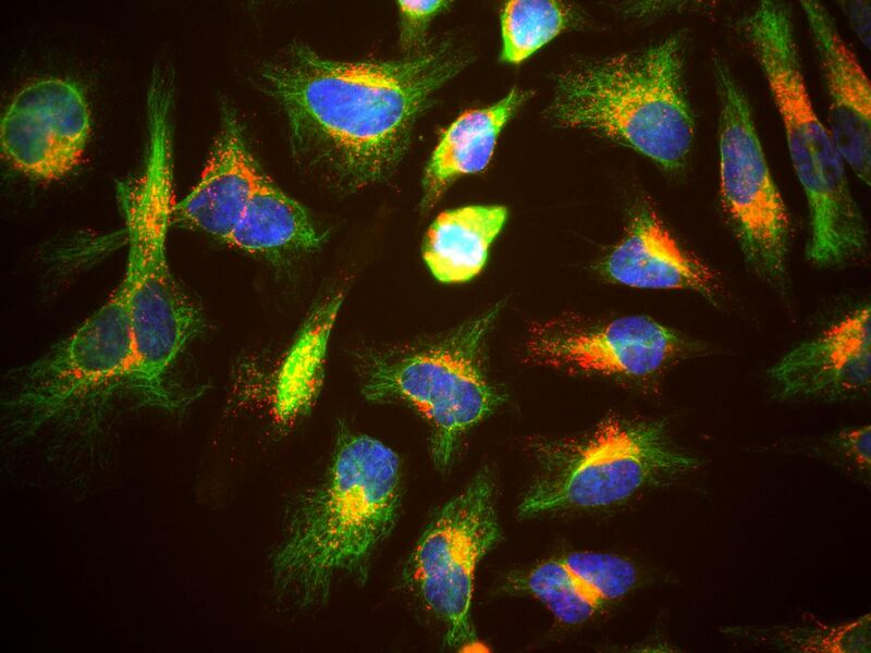 File:HeLa cells showin Lamp1 in red, vimentin in green and DNA in blue.jpg