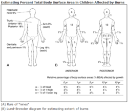 Lund-Browder chart-burn injury area.PNG