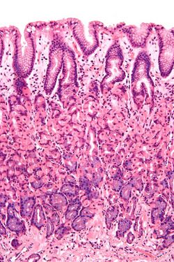 Normal gastric mucosa intermed mag.jpg