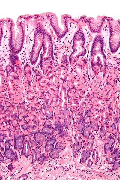 File:Normal gastric mucosa intermed mag.jpg