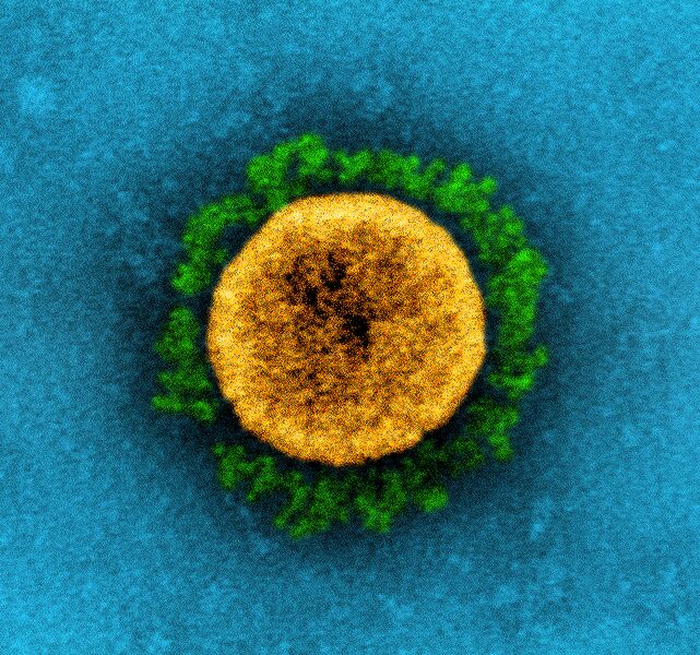 File:Novel Coronavirus SARS-CoV-2 (50960620707) (cropped).jpg