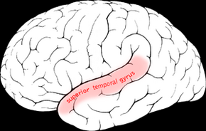 Superior temporal gyrus.png
