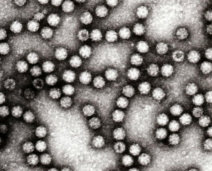 File:Astrovirus 4.jpg