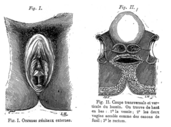 Double vagina Vagina duplex from Golay 1875.png