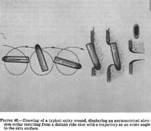 A illustration shows the bullet, which had hit Kennedy a moment before, rotating and tumbling before entering Connally's skin, causing his entry wound.