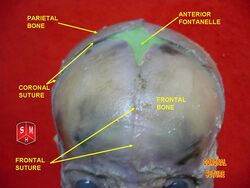 Coronal suture.jpg