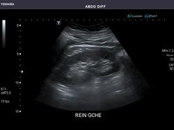 Abdominal Ultrasound Full Exam 51.jpg