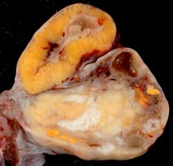 human ovary with corpus luteum fixed specimen