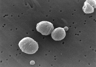Scanning Electron Micrograph of Streptococcus pneumoniae.