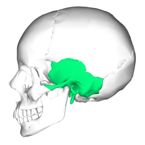 Temporal bone lateral5.png