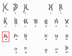 Human male karyotpe high resolution - Chromosome 13.png