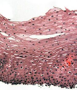 Histological section of the esophageal wall.