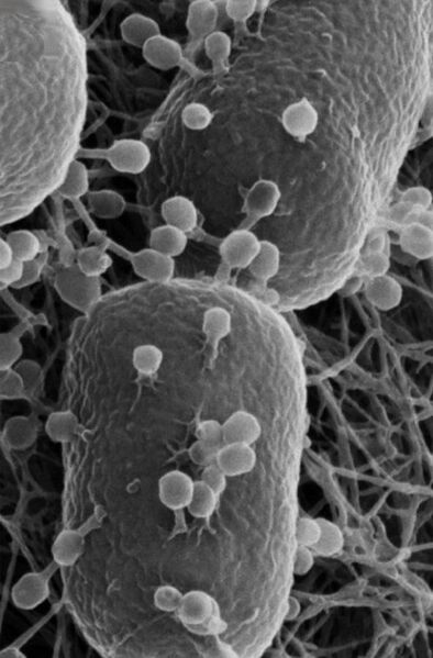 File:Escherichia coli with phages.jpg