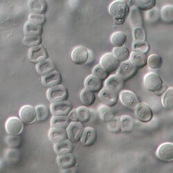 Trichophyton verrucosum chlamydospores.jpg