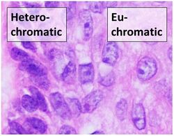 Heterochromatic versus euchromatic nuclei.jpg